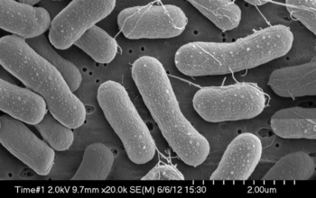 micrograph showing methane-eating bacteria